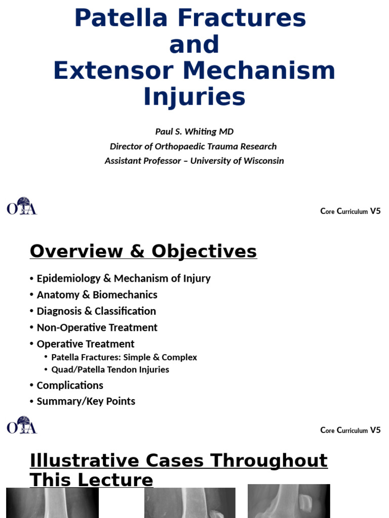 Patella Fractures & Extensor Injuries Guide | PDF | Knee ...