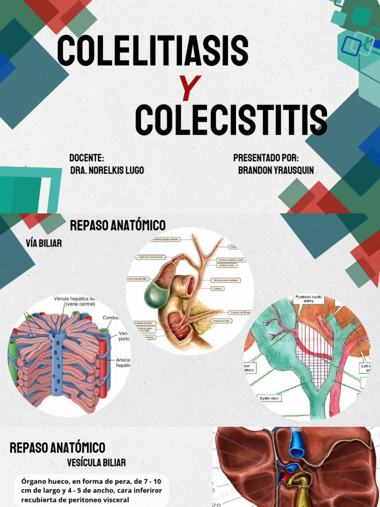 Colelitiasis y Colecistitis | PDF | Vesícula biliar | Bilis
