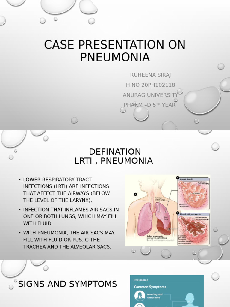Case Presentation - Pneumonia 20ph102118. Ruheena | PDF | Pneumonia ...