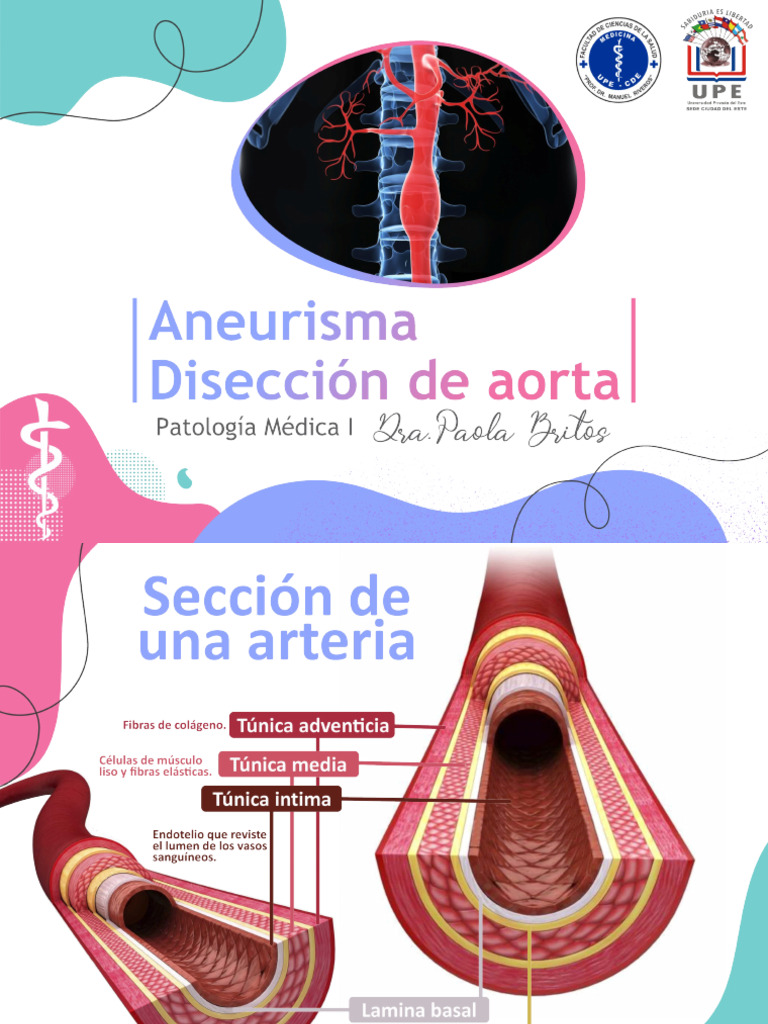 Aneurismas Aórticos: Tipos y Diagnóstico | PDF | Aorta | Enfermedades y ...