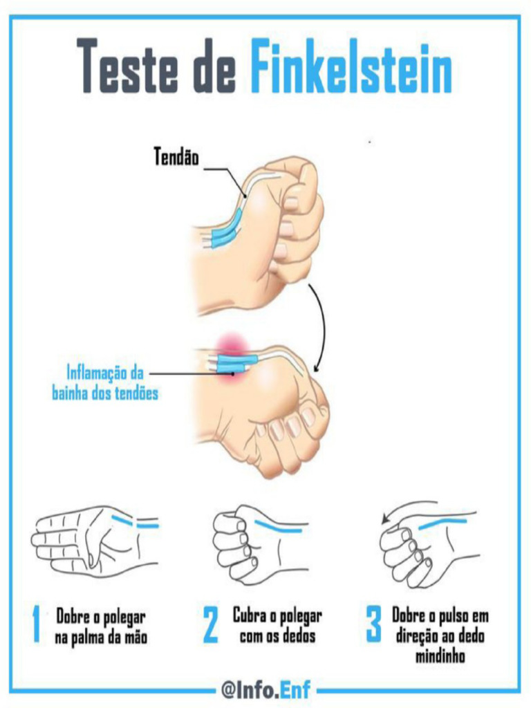 Finkelstein | PDF