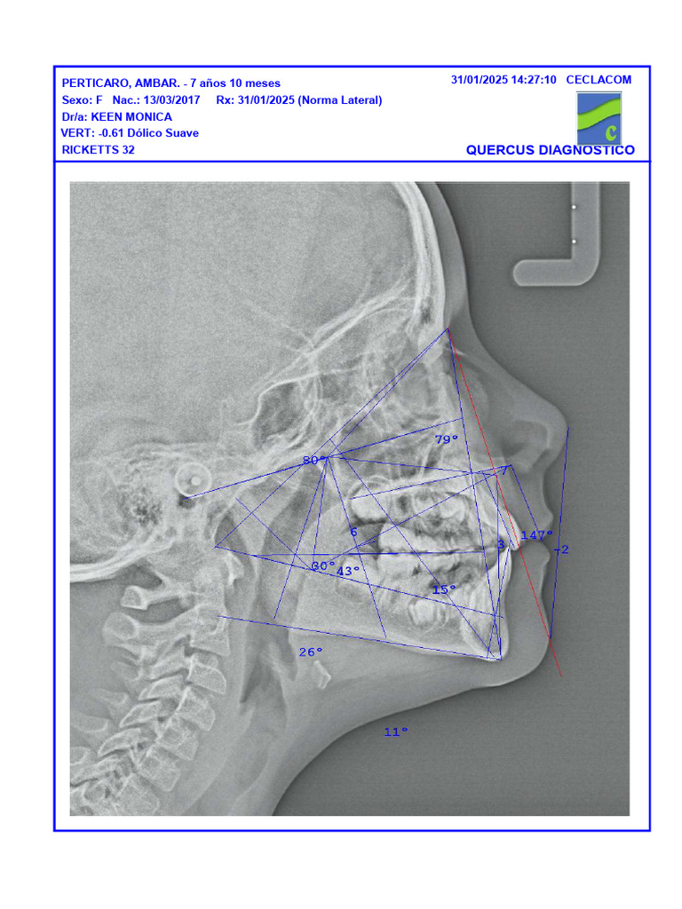 Graficos Ricketts | PDF