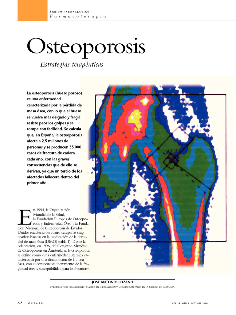 Osteoporosis: Estrategias y Tratamientos | PDF | Osteoporosis | Hueso