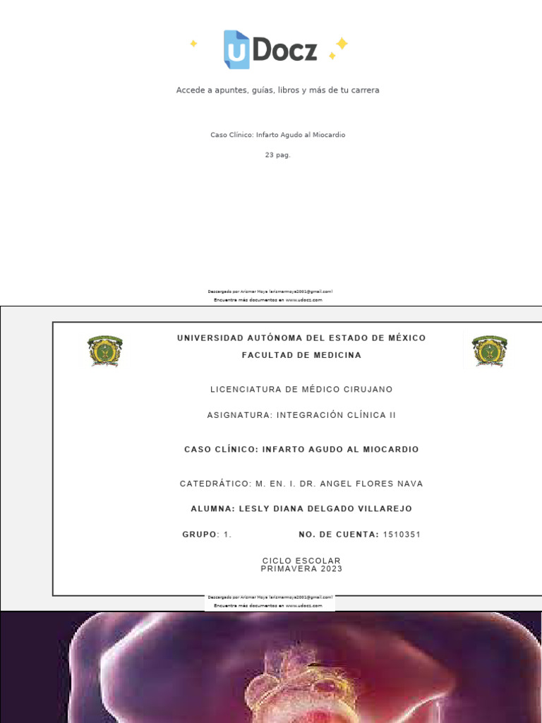 Caso Clínico: Infarto Agudo al Miocardio | PDF | Infarto de miocardio ...