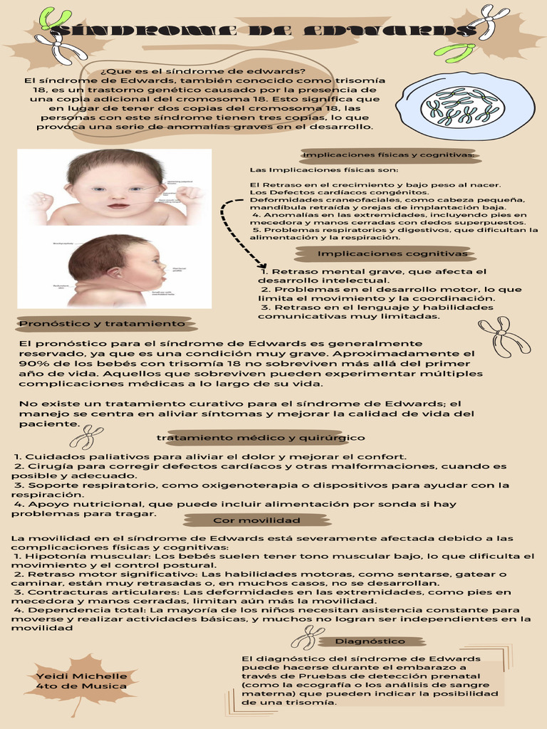 Síndrome de Edwards | PDF
