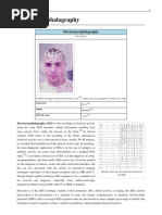 Download EEG by adibaroness SN83322731 doc pdf