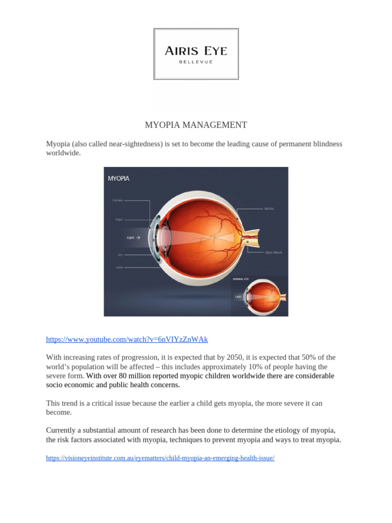 Child Myopia Management Strategies | PDF | Myopia | Contact Lens