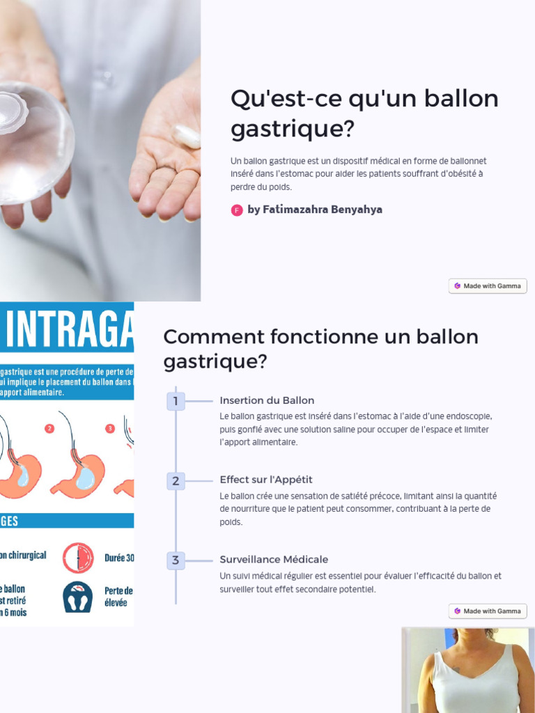 Ballon gastrique : fonctionnement et avantages | PDF