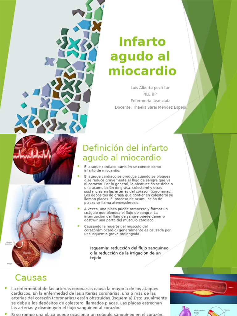 Infarto Agudo Al Miocardio | PDF | Infarto de miocardio | Isquemia