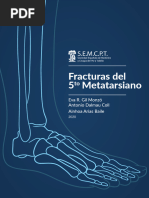 Clasificación y tratamiento de fractura de Jones | PDF | Hueso ...