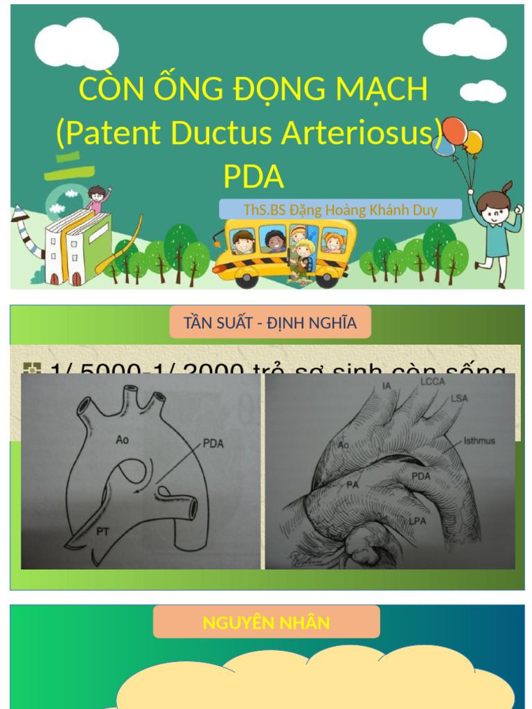 Pda Hiu | PDF