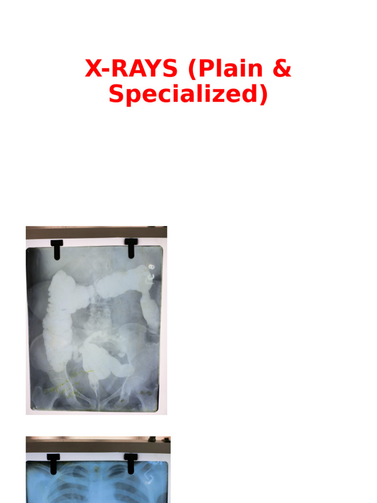 X-Rays: Types and Applications | PDF