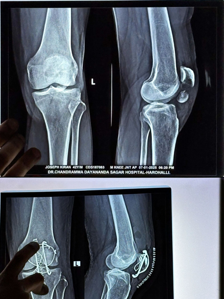 Ortho Xray | PDF