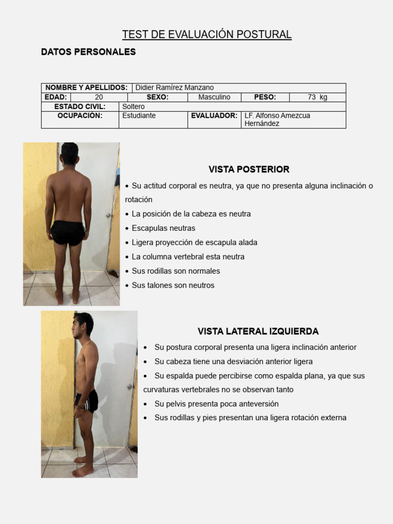 Evaluacion postural | PDF