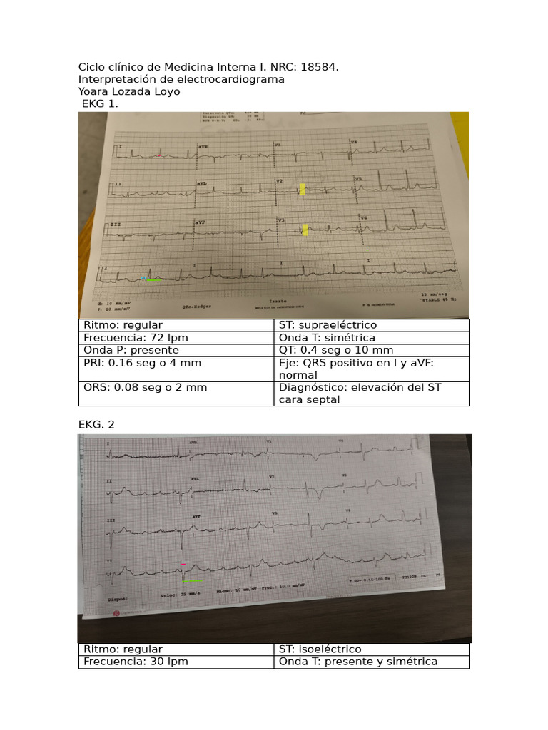 Interpretación EKG 3 | PDF | Enfermedades y trastornos | Especialidades ...