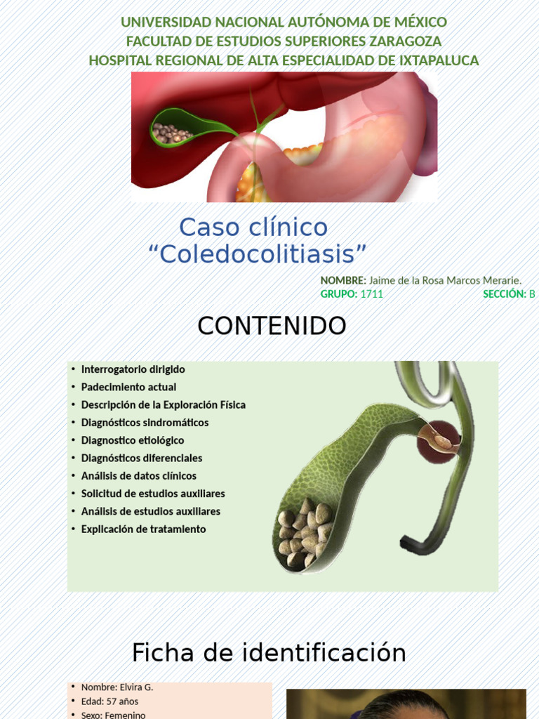 Diagnóstico y Manejo de Coledocolitiasis | PDF | Sistema digestivo ...