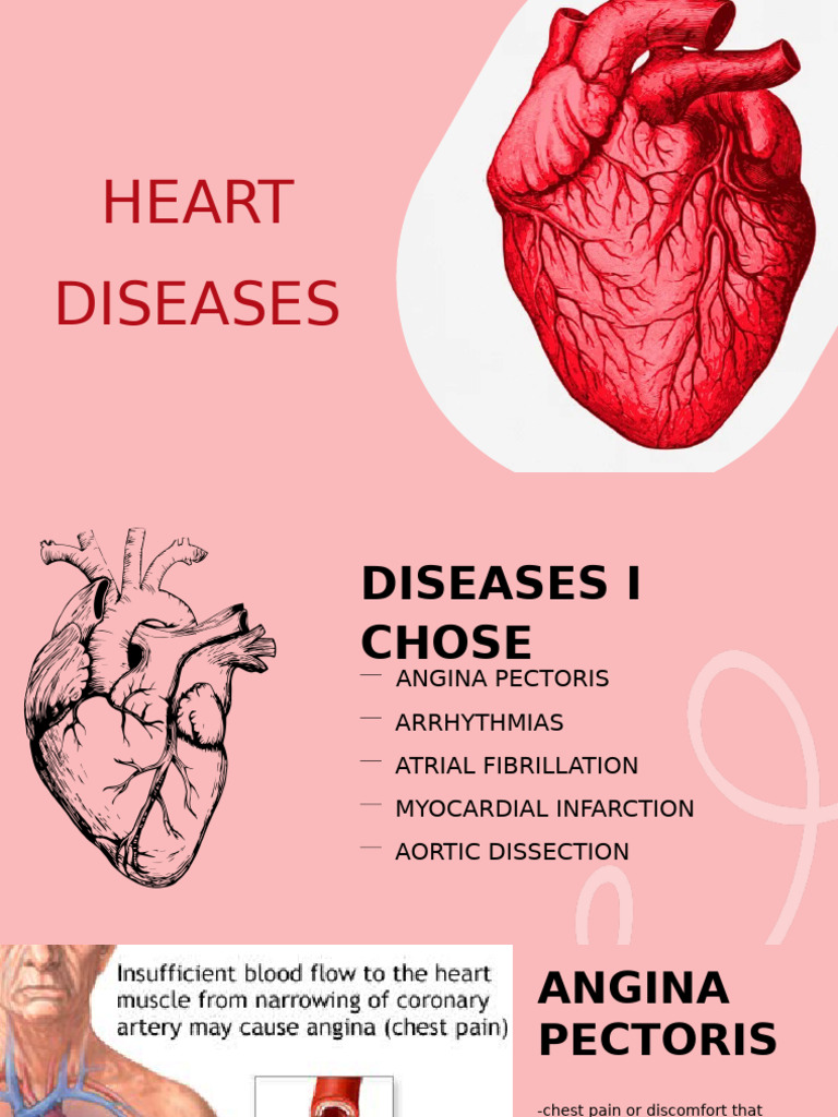 Heart Disease Overview | PDF