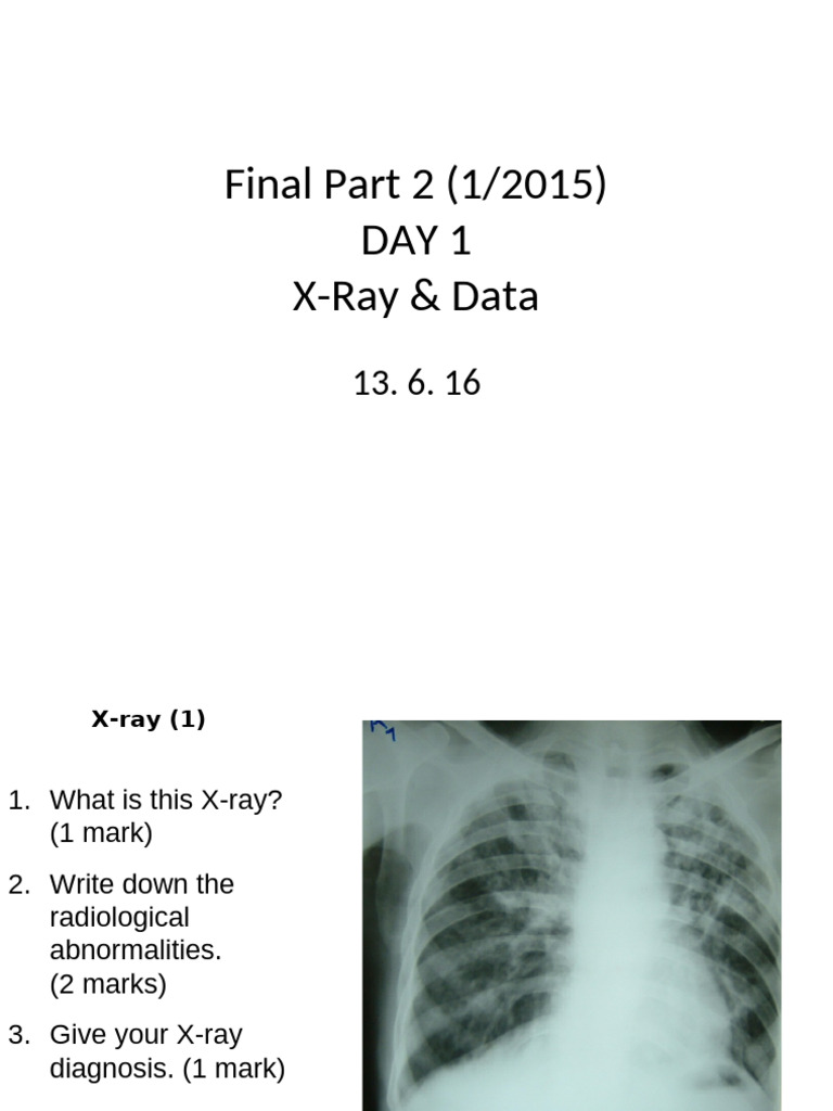 FP2 Day 1 Xray Data | PDF