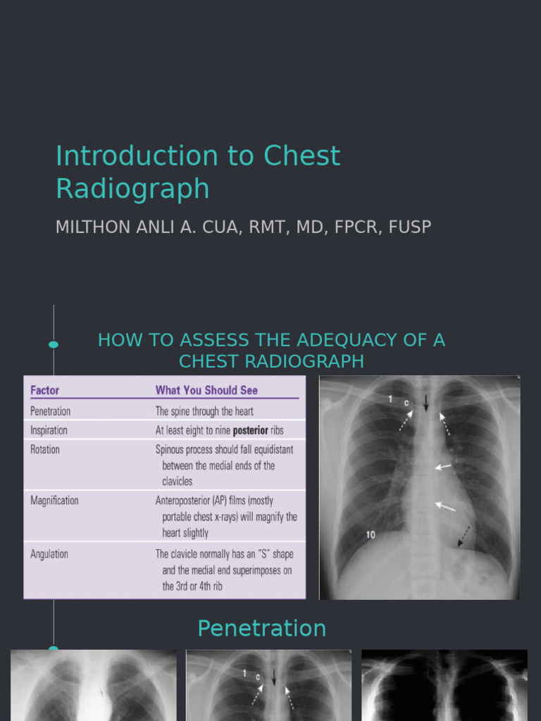 Chest Radiograph Assessment Guide | PDF | Lung | Respiratory Diseases