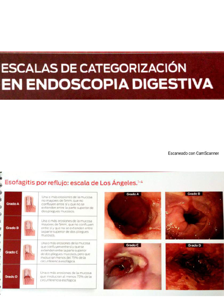 Escalas de Categorización en Endoscopia Digestiva | PDF
