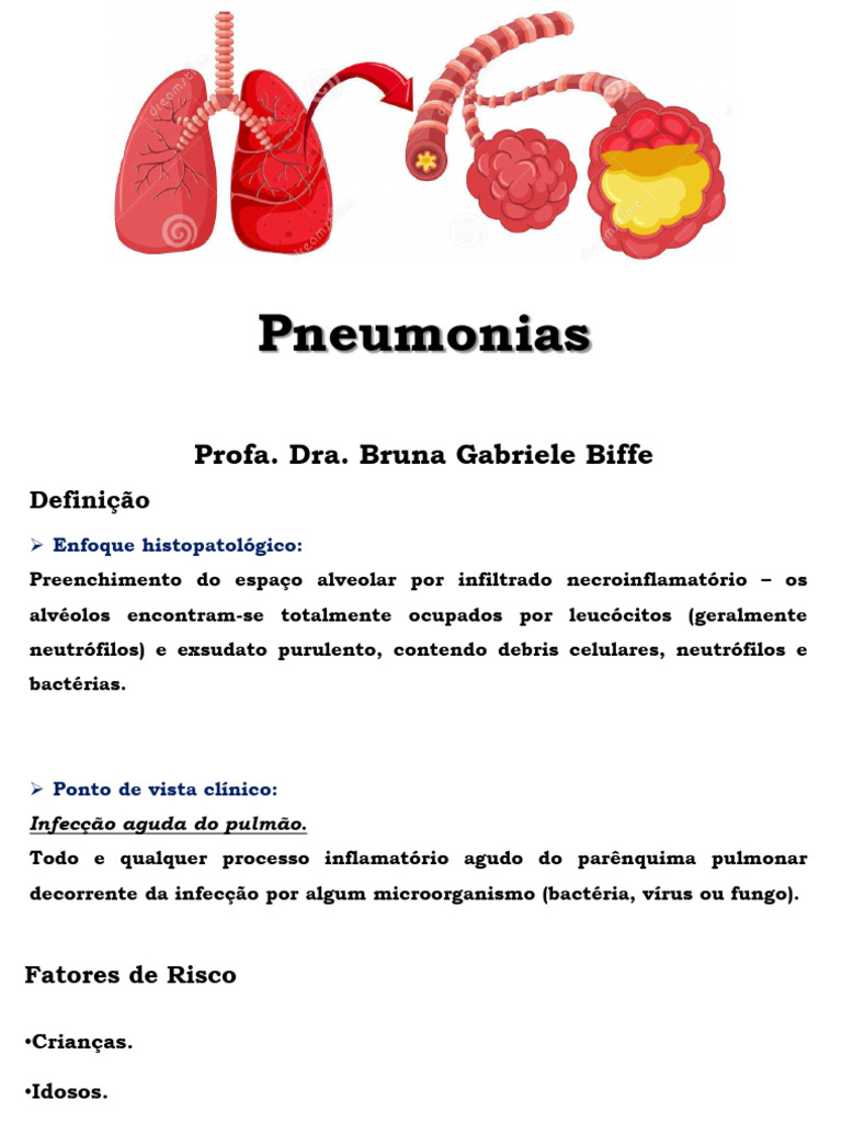 Pneumonias: Tipos, Causas e Diagnóstico | PDF | Pneumonia | Infecção