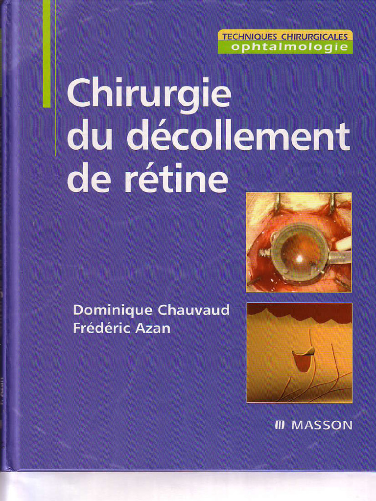 Chirurgie Du Decollement de Retine | PDF