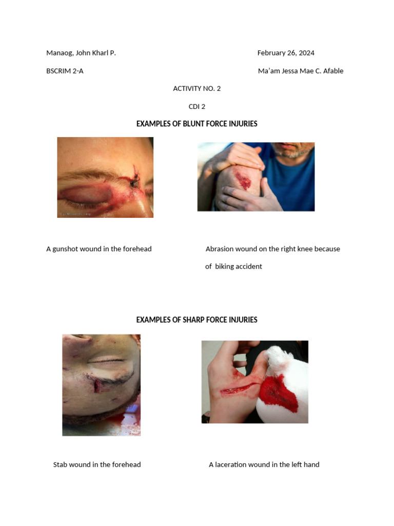 Blunt and Sharp Force Injury Examples | PDF