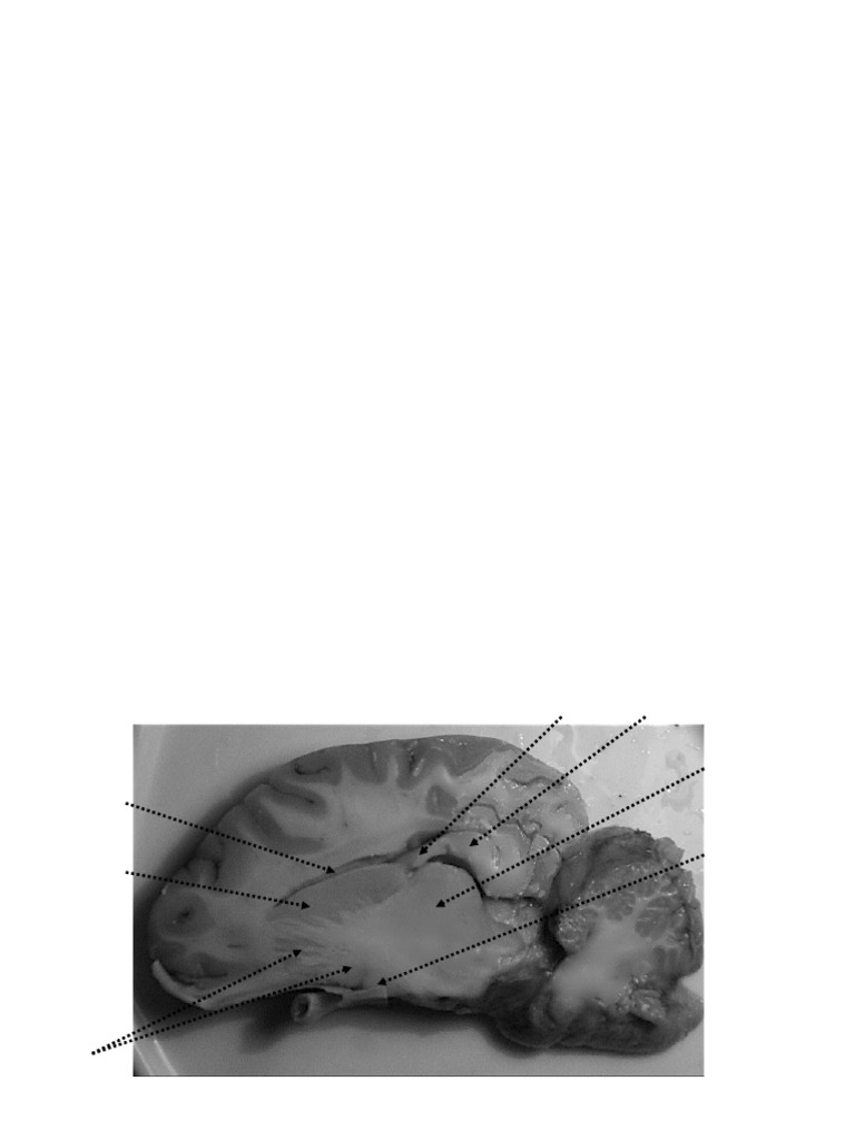 Lateral Sagittal Views of Sheep Brain | PDF | Cerebrum | Thalamus