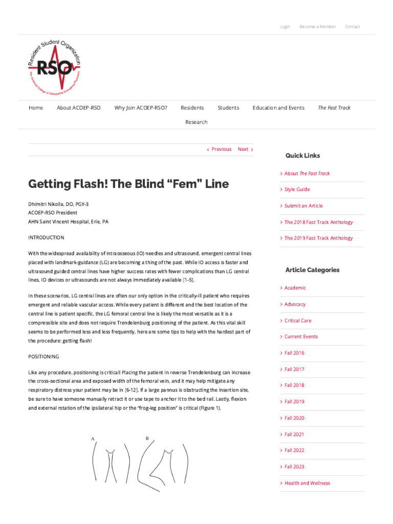 Tips for Blind Femoral Central Line Access | PDF | Hip | Vein