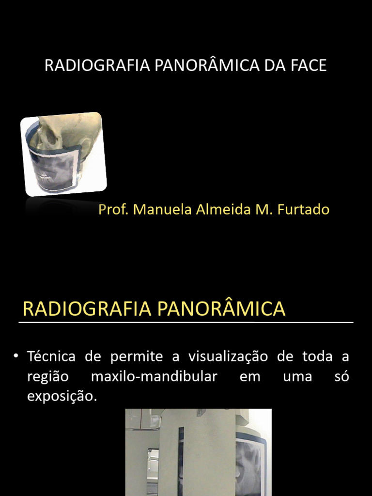 Radiografia Panorâmica: Indicações e Interpretação | PDF