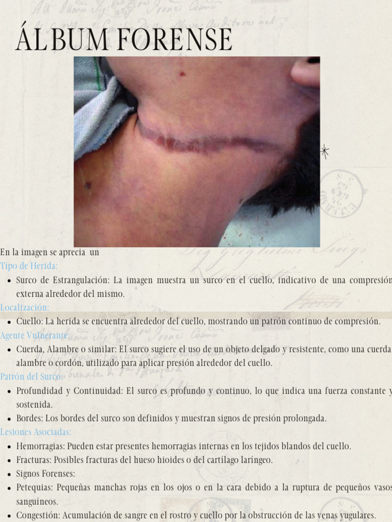 Análisis de Surco de Estrangulación | PDF