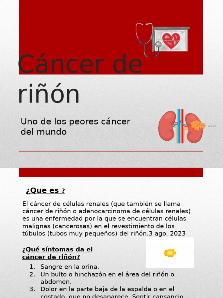 Cáncer de riñón: síntomas y tratamiento | PDF