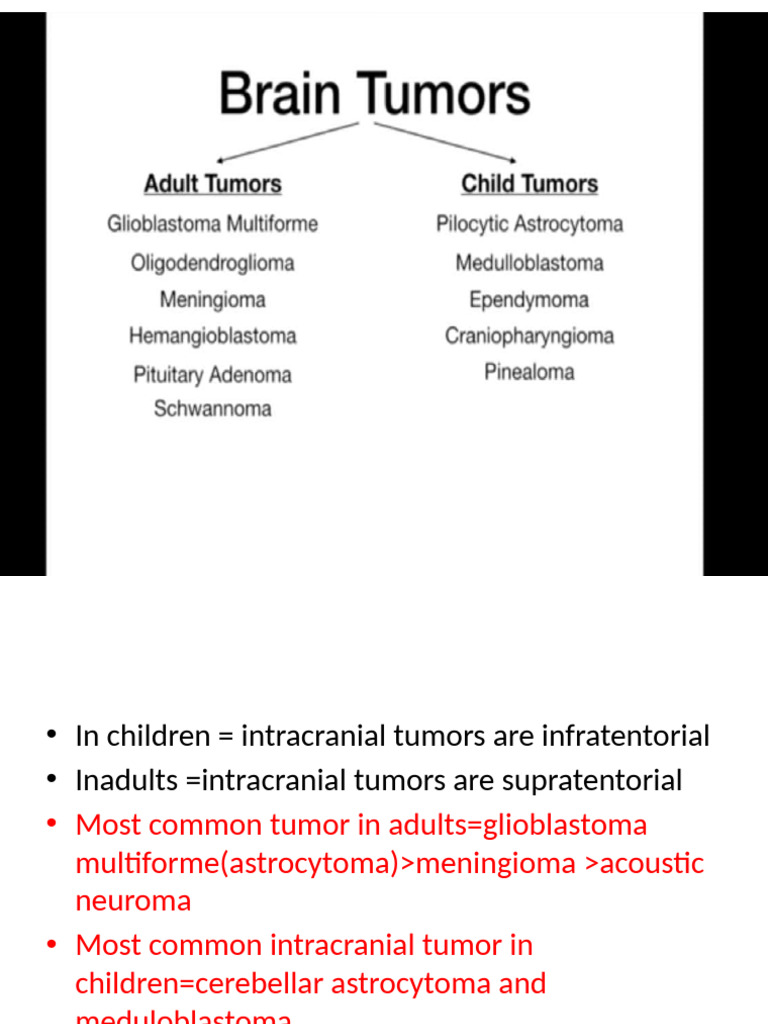 Intracranial Tumors in Children and Adults | PDF