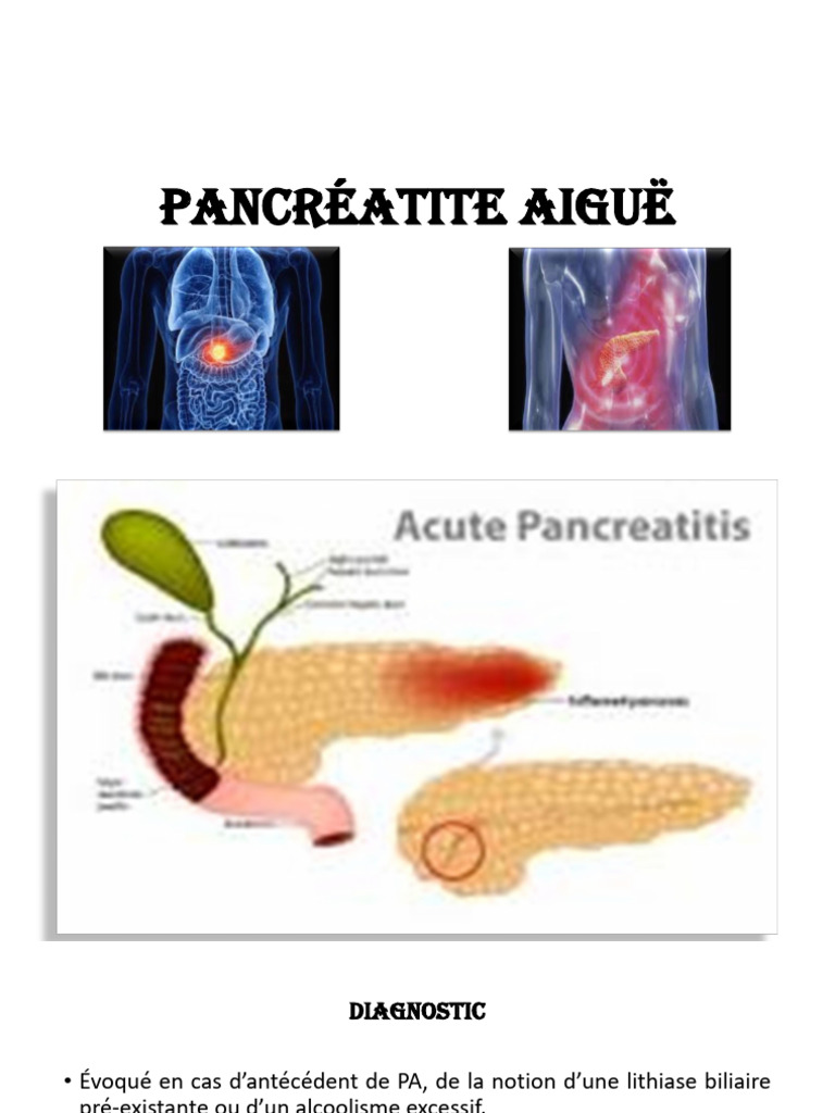 Diagnostic de la Pancréatite Aiguë | PDF | Hépatite B | Foie