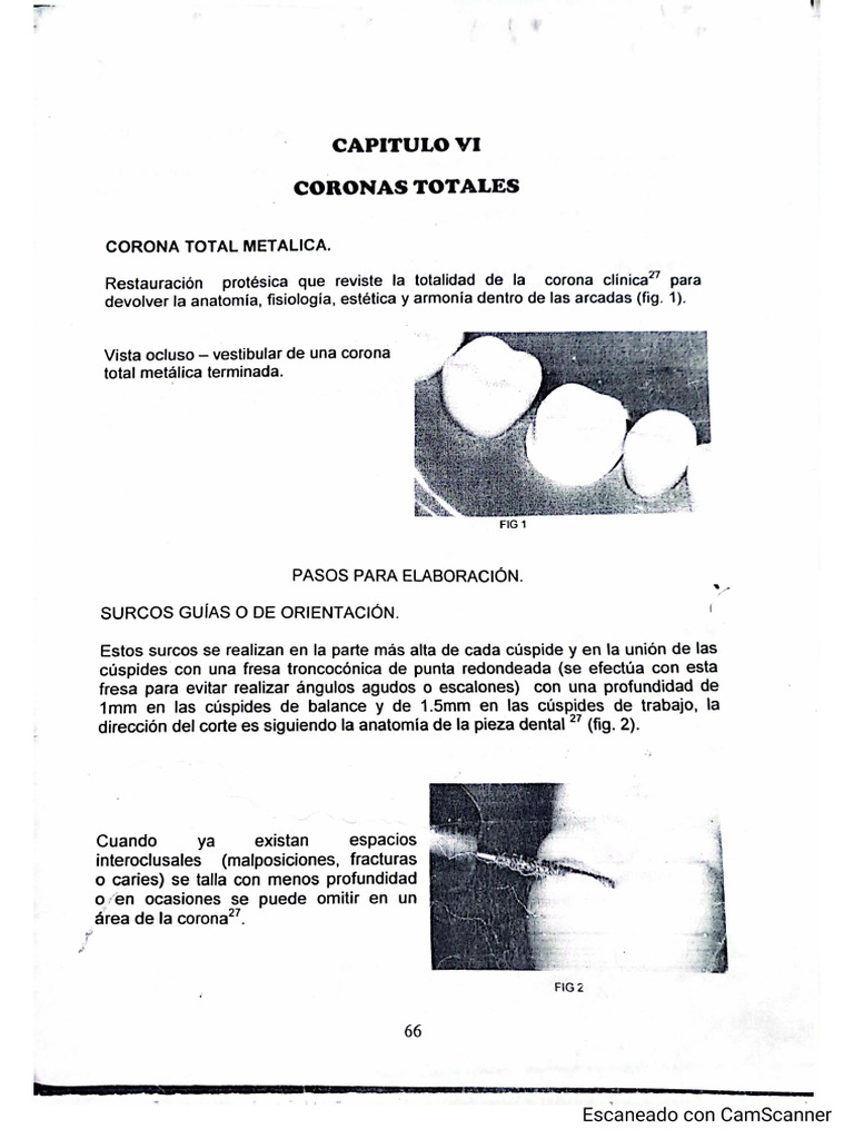 Coronas Totales Metálicas | PDF