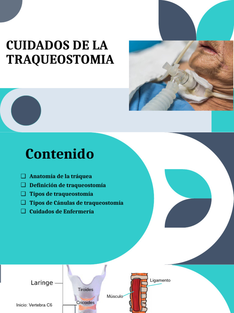 Tipos de Traqueostomía y Cuidados | PDF | Laringe | Tiroides