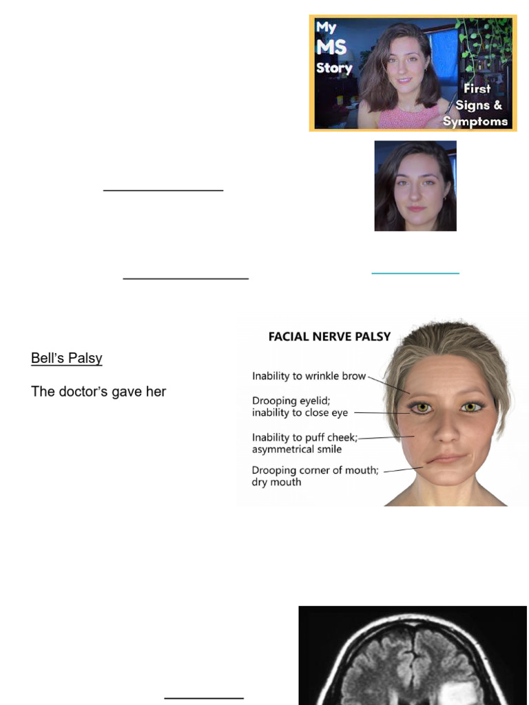 Nervous+System+Part+1+PPT | PDF | Neurotransmitter | Myelin