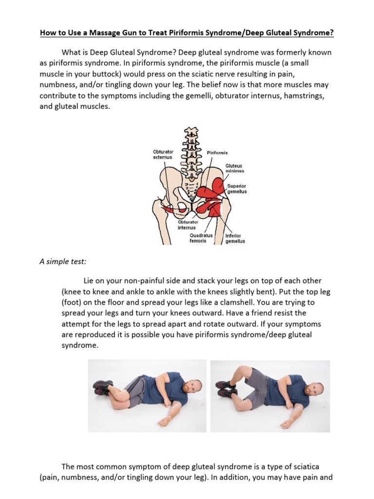 19-how-to-use-a-massage-gun-to-treat-piriformis-syndrome-deep-gluteal
