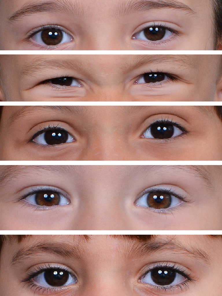 Eye | PDF