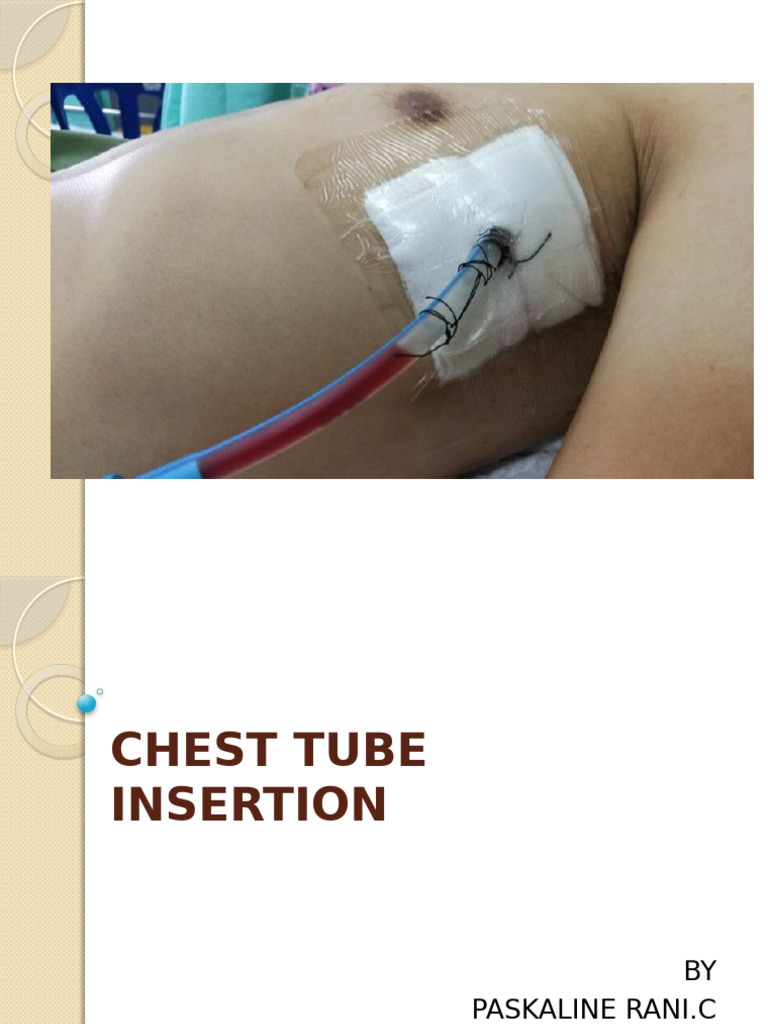 Chest Tube Insertion Procedure Guide | PDF | Surgical Specialties ...