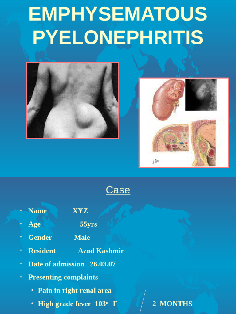 Emphysematous Pyelonephritis Overview | PDF | Kidney | Blood Plasma