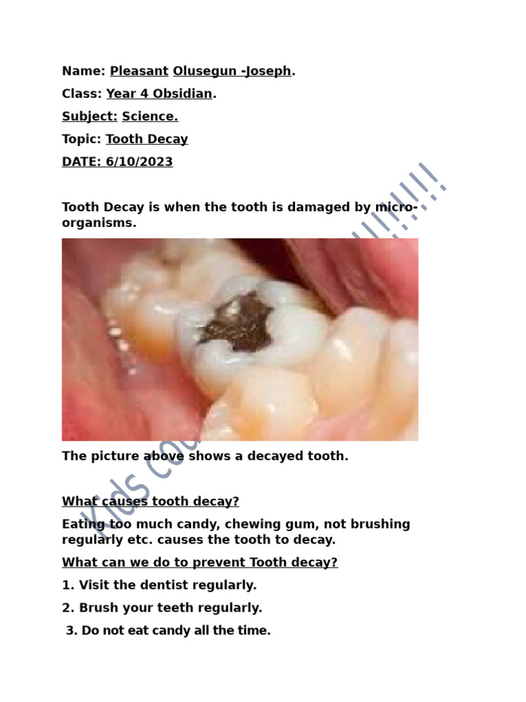 Understanding Tooth Decay Causes & Prevention | PDF