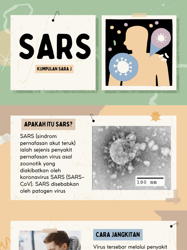 Sars PDF | PDF