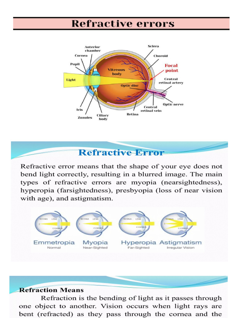 Refractive Errors | PDF