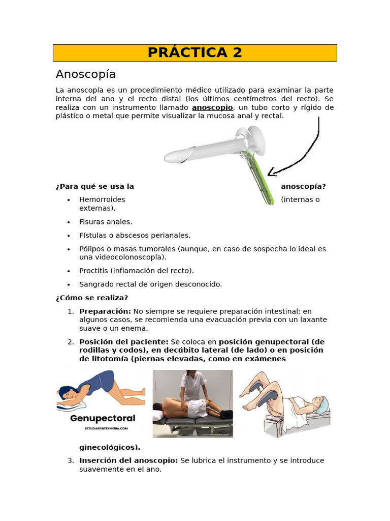 Anoscopía: Procedimiento y Hemorroides | PDF | Hemorroides ...