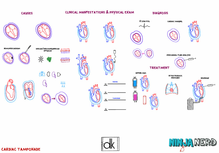 Cardiac Tamponade | PDF