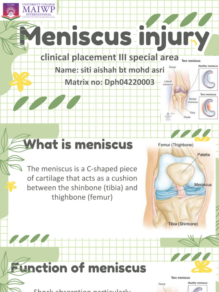 Miniscus Injury | PDF