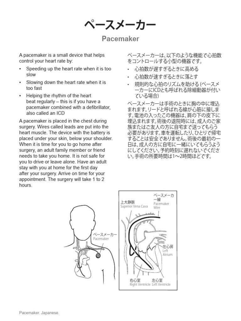 Pacemaker JPN | PDF