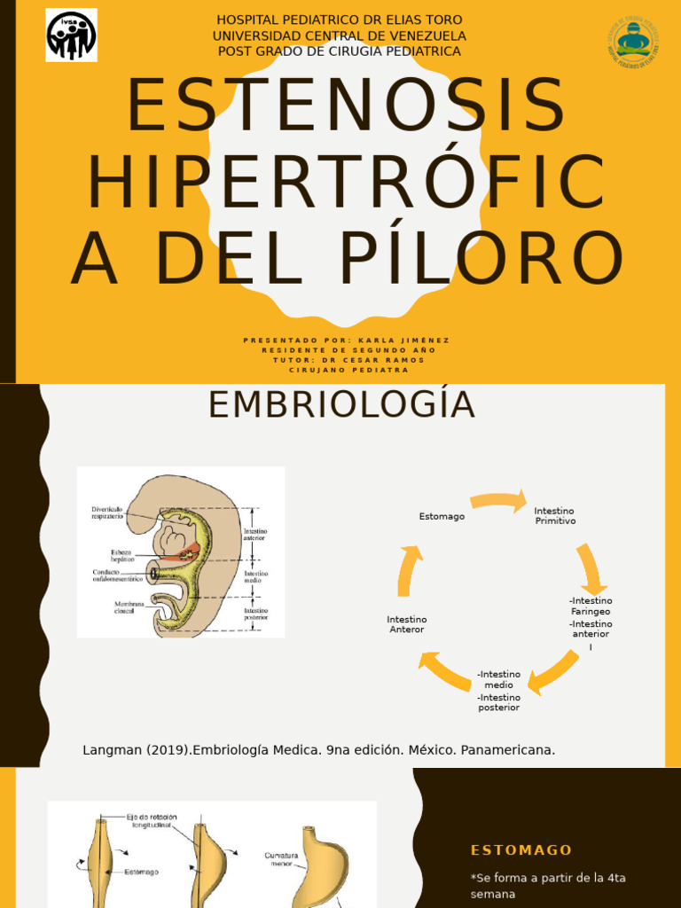 Estenosis Hipertrófica del Píloro | PDF | Estómago | Abdomen