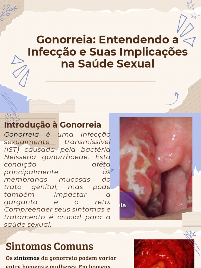 Slidesgo Gonorreia Entendendo A Infeccao e Suas Implicacoes Na Saude ...